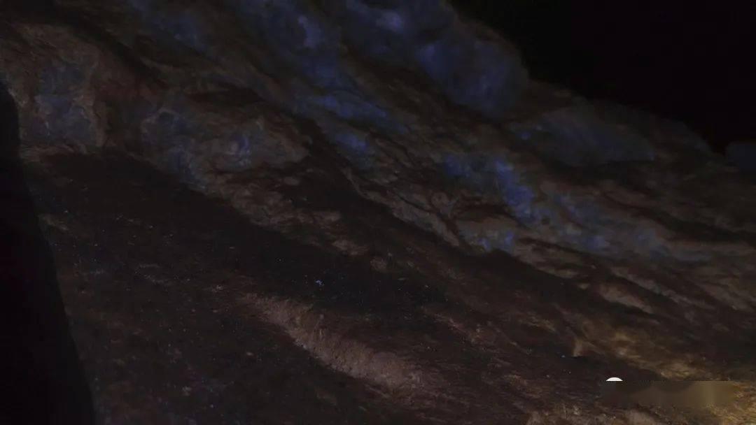 牙缝里的牙结石如何去除？牙科生教你几个妙招，牙垢牙石唰唰掉！